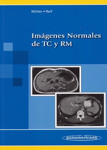 IMAGENES NORMALES DE TC Y RM | 9788479035143 | MOLLER, TORSTEN B. | Librería Castillón - Comprar libros online Aragón, Barbastro