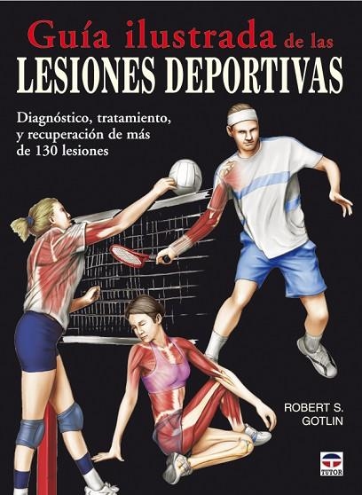 GUÍA ILUSTRADA DE LAS LESIONES DEPORTIVAS | 9788479027841 | Gotlin, Robert S. | Librería Castillón - Comprar libros online Aragón, Barbastro